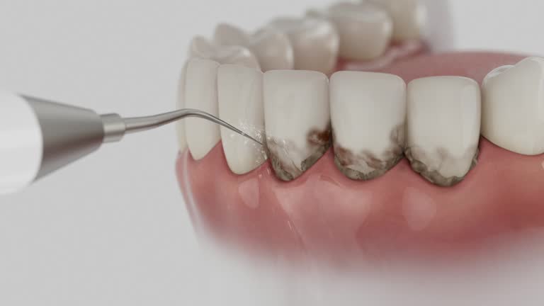 Trusted Invisalign Clear Aligners service in Brooklyn Park, MD - Dentist Open Now